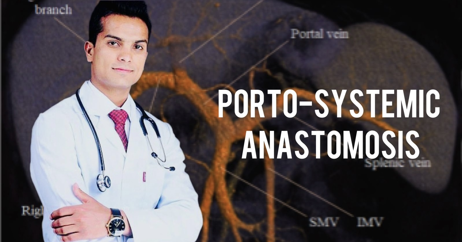 Porto systemic anastomoses part B