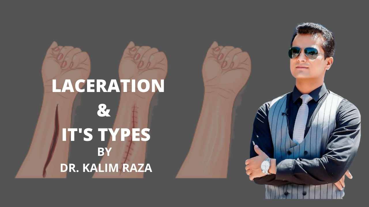 Laceration and its types