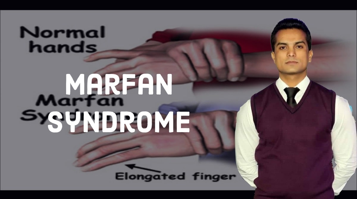 Marfan syndrome
