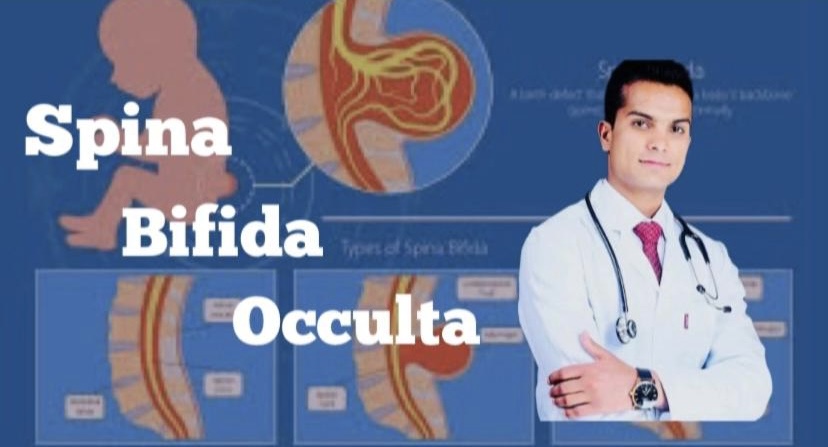 Spina bifida occulta Meningocele and myelomeningocelde