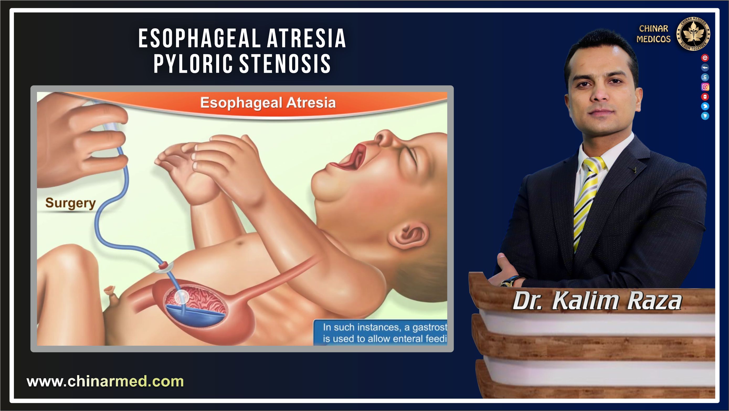 Dudenal atresia and pyloric stenosis