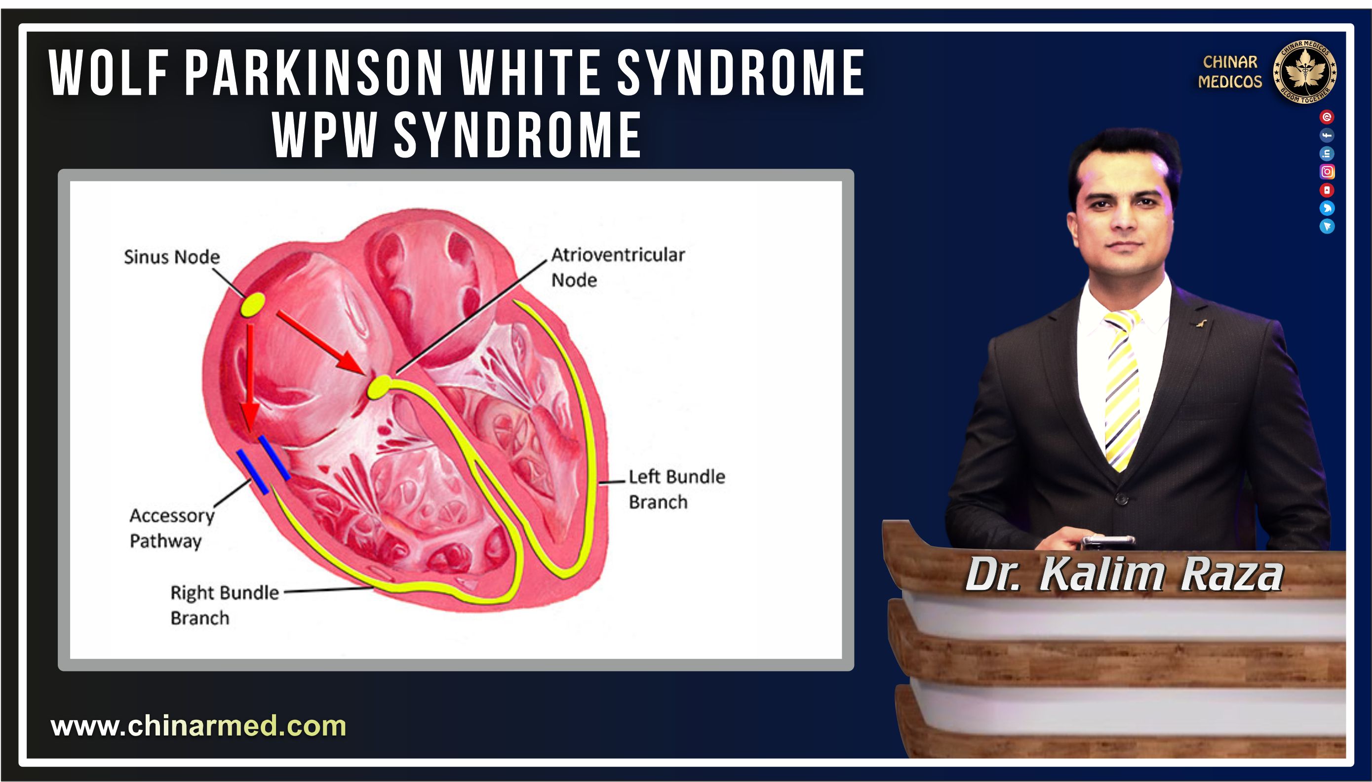 WPW syndrome