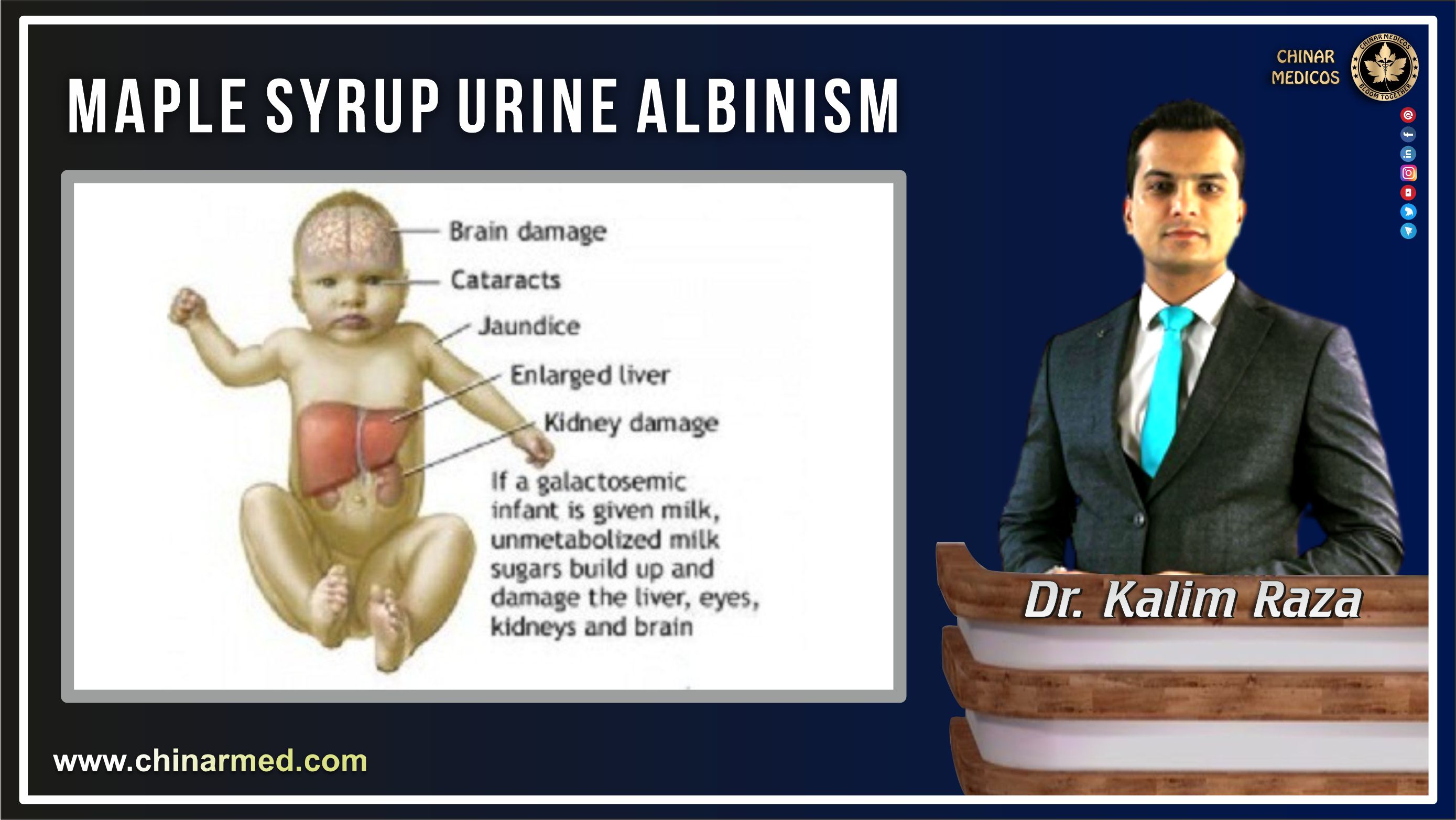 Maple syrup urine disease