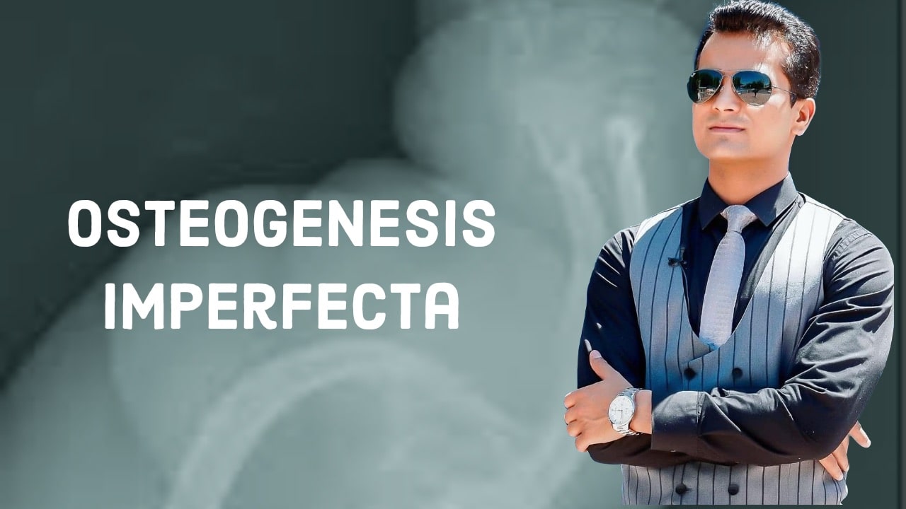 Osteogenesis imperfecta and Ehler danlos syndrome