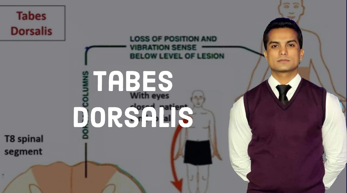 Tabes dorsalis