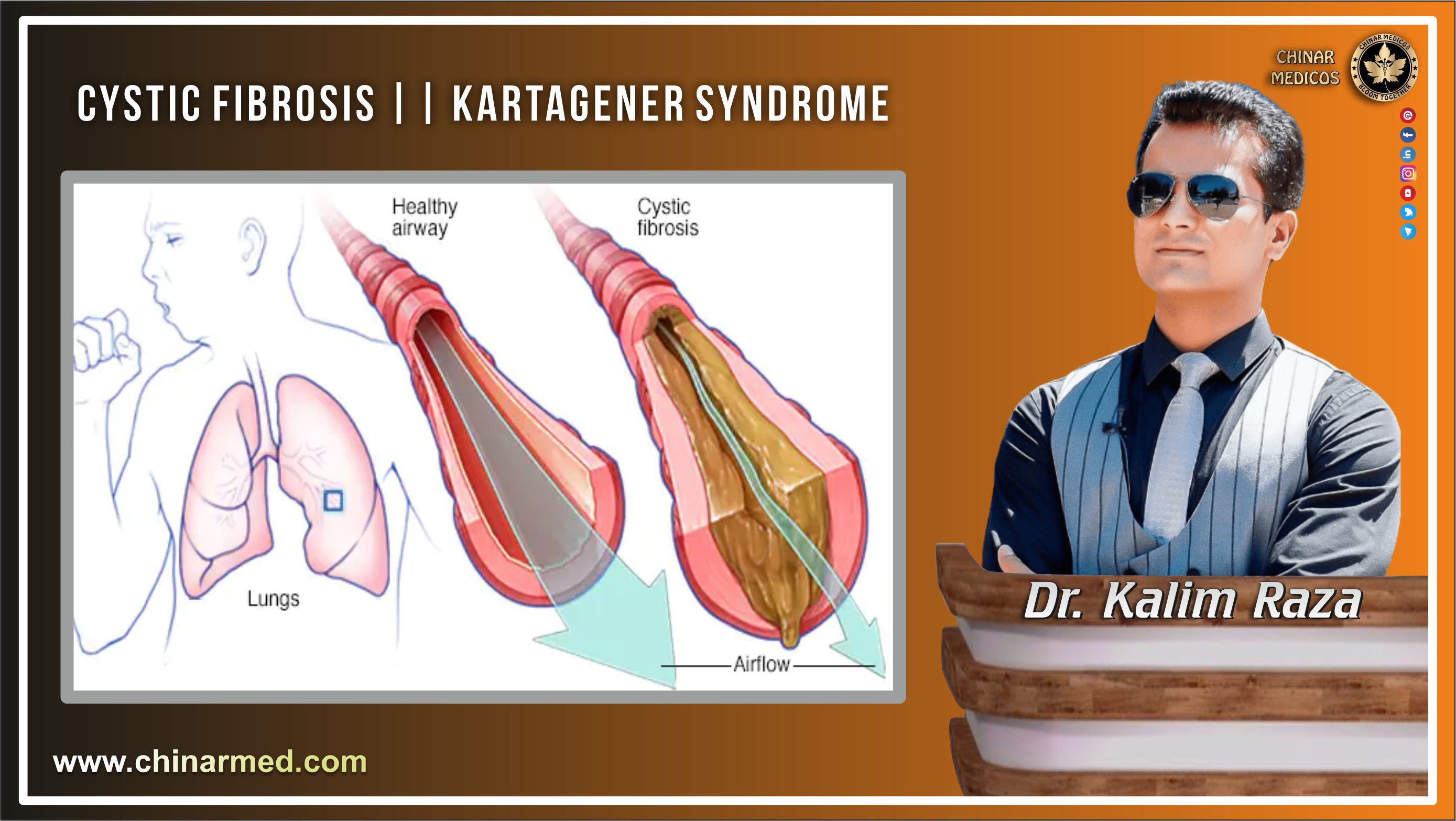 Cystic fibrosis and kartagener syndrome