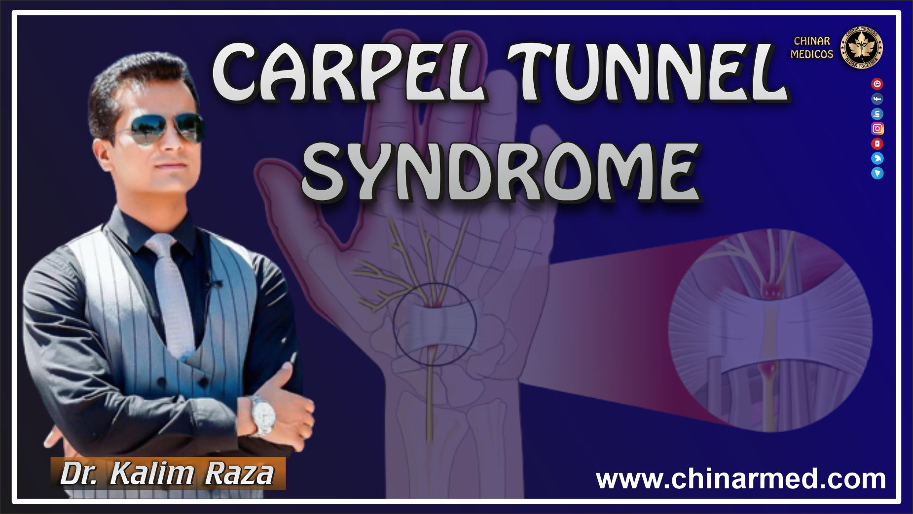 Carpal tunnel syndrome