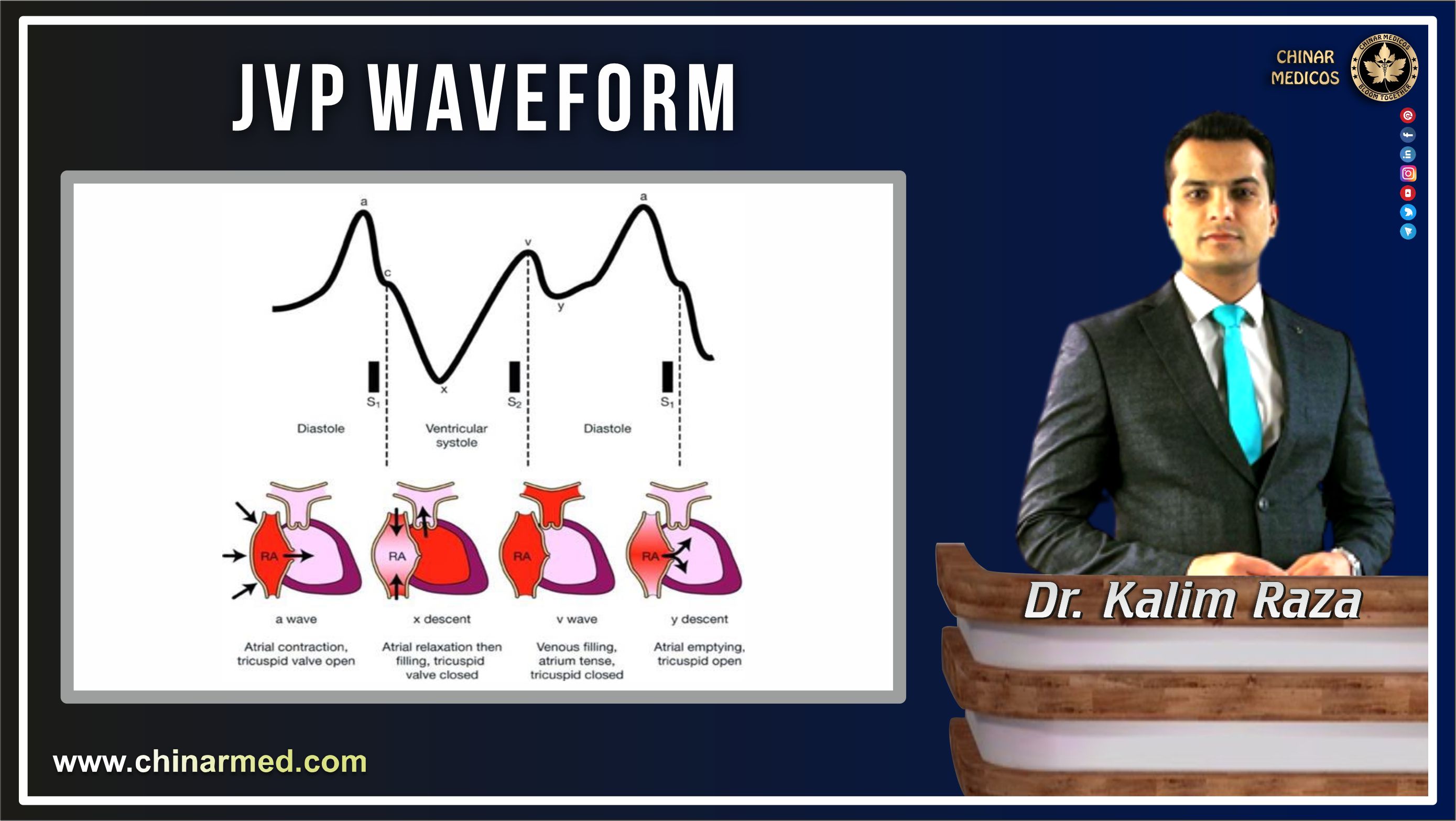 JVP waveform