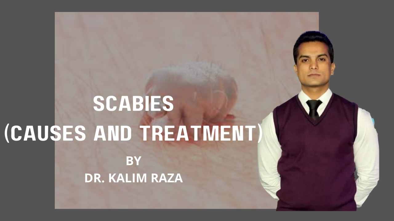 Scabies and its prevention
