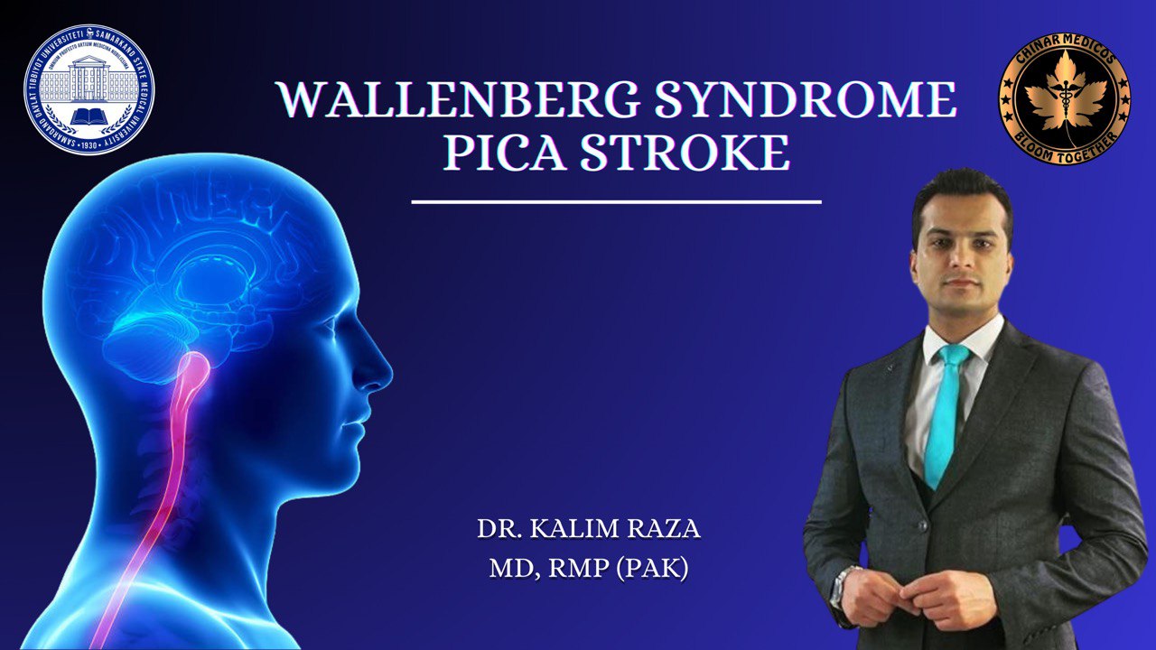 WALLENBERG syndrome and PICA stroke
