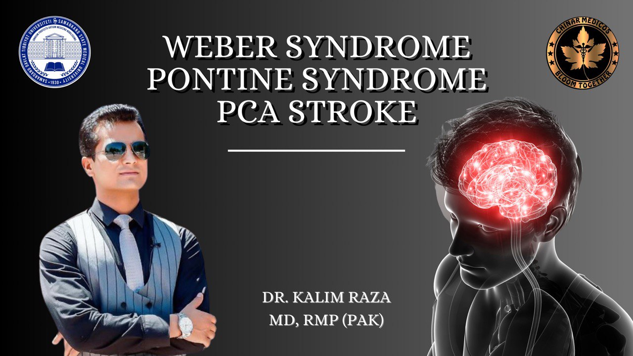 Weber syndrome PCA stroke PONTINE syndrome